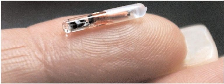 Kaspersky Lab pētīs implantējamo mikroshēmu ievainojamības