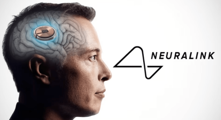 Pirmais cilvēks saņēmis “Neuralink” smadzeņu implantu