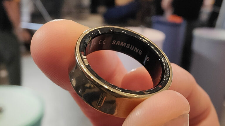 Uzpūtusies “Galaxy Ring” viedā gredzena baterija nosūtījusi tā valkātāju uz slimnīcu